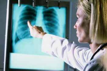 X-光胸片检查支气管炎