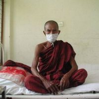 结核病与艾滋病的关联比原先知道的更为紧密