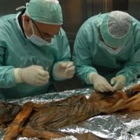 对世界上最古老的木乃伊“冰人奥茨”的DNA分析发现了什么健康问题？